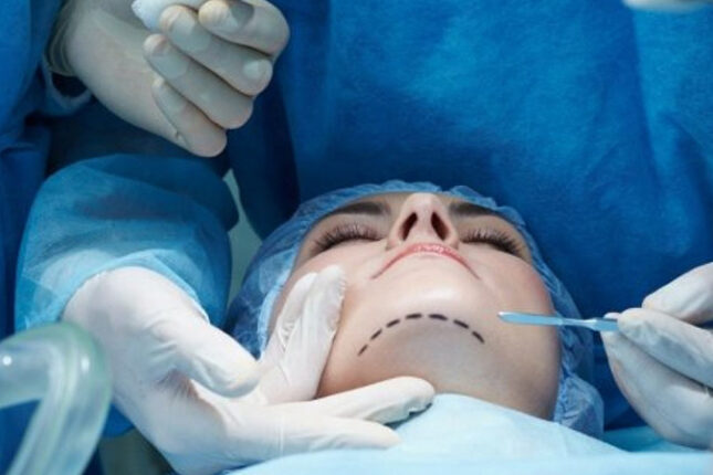 Plastik cərrahların fəaliyyətinin yoxlanılması nə vaxt başa çatır?
