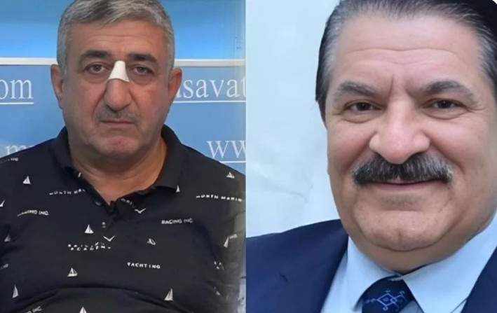 Ağadadaş Ağayevin balta atdığı mühafizəçi həbs edilib