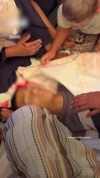 İsrail Qəzzada 82 nəfəri öldürdü; Rafahın "həbs düşərgələri" planı alt-alt oldu