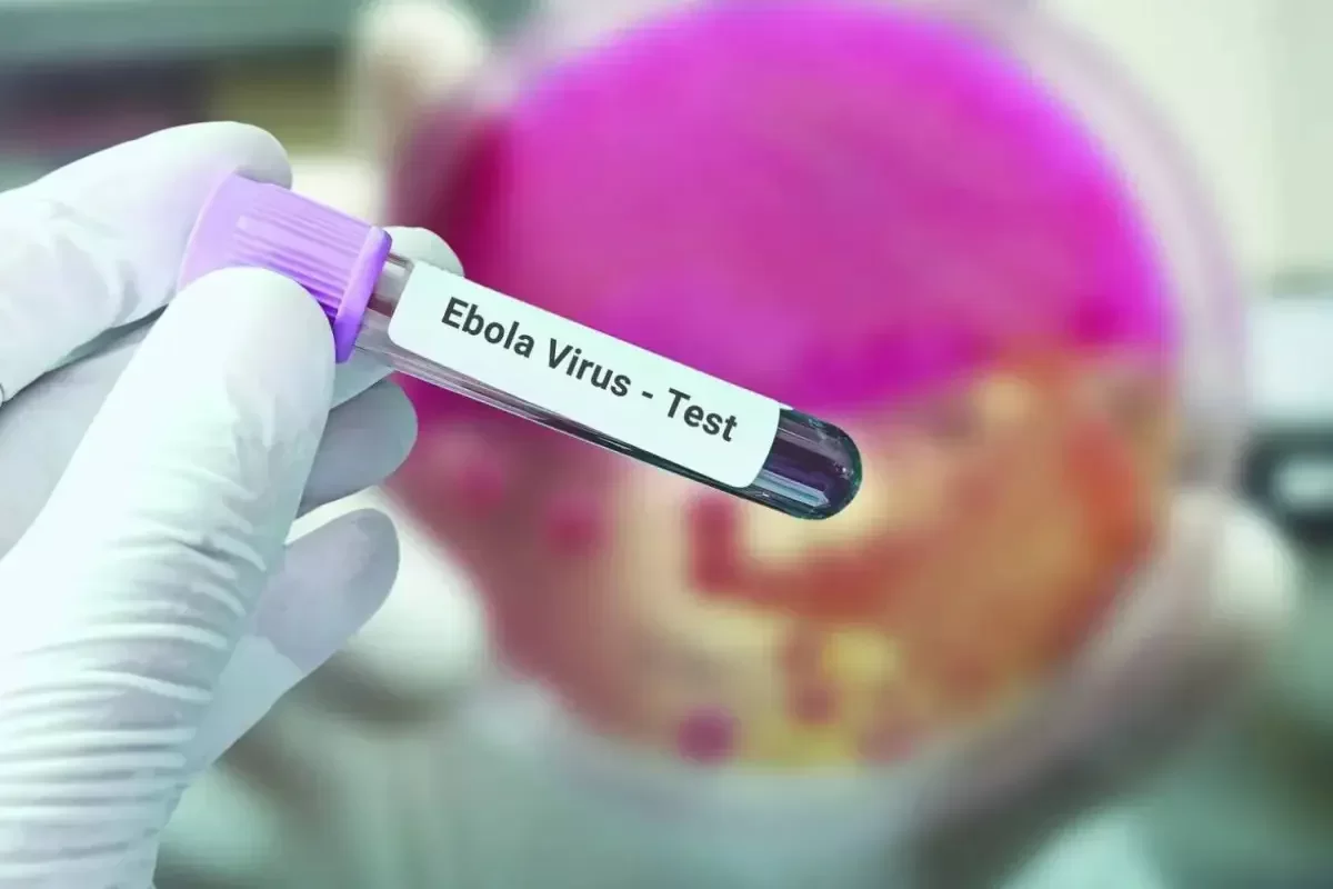 Ebola tüğyan edir: Afrikada 9 minə yaxın insan yoluxub, 4336 nəfər həyatını itirib